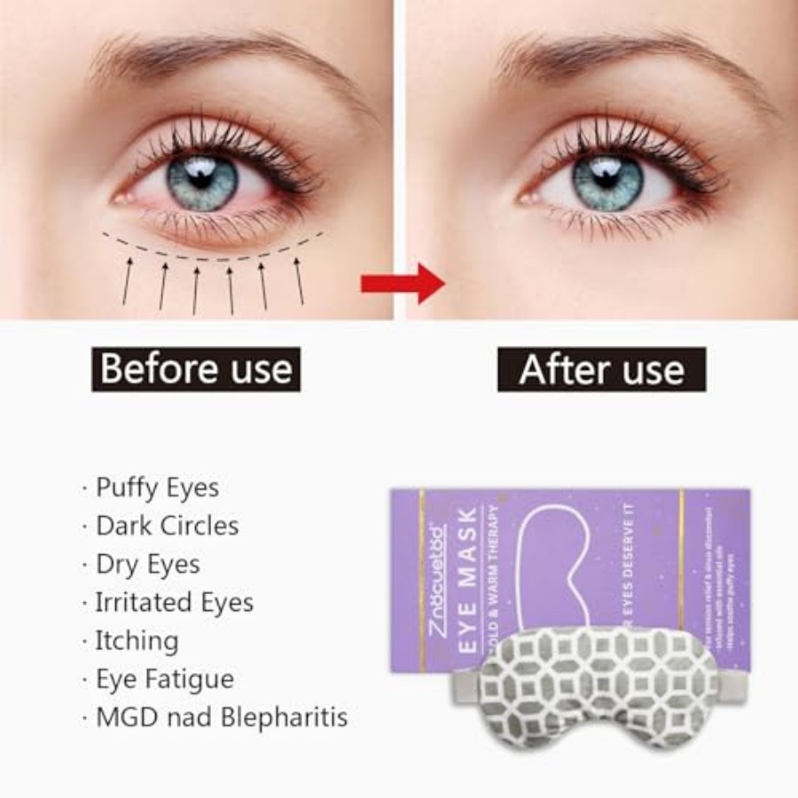 2 in 1 Heated/Ice Eye Mask Moi - Eye Mask Heated 리뷰 및 가격